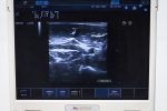 USG przenośne Esaote MyLab 25 Gold Ultrasonograf + 3 głowice - obrazek 13