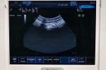 USG przenośne Esaote MyLab 25 Gold Ultrasonograf + 3 głowice - obrazek 12