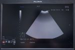 USG Ultrasonograf Aloka Prosound F75 + 3 głowice - obrazek 9