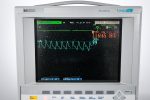 Kardiomonitor HP M1205A Monitor Pacjenta