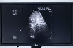 BK Medical Falcon 2101 EXL Aparat USG + 2 Sondy
