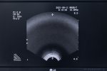 BK Medical Falcon 2101 EXL Aparat USG + 2 Sondy