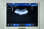 Esaote MyLab Five Przenośne USG Ultrasonograf