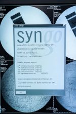 Używany śródoperacyjny aparat RTG SIEMENS ARCADIS Varic VC 10A: Ramię C z wózkiem monitorów Rok produkcji 2010, lampa rok 2009 Zakres ruchu orbitalnego 130° Wzmacniacz obrazu 9″ Tor wizyjny w pełni cyfrowy (rozdzielczość 1024×1024) EASY – system akwizycji z automatycznym doborem dawki, kontrastu i jasności Aparat wyposażony w silną lampę (prąd do 13 mA), której parametry cieplne umożliwiają jej nieprzerwaną pracę przez ponad 50 min Zasilanie: 230 V, 50/60 Hz, Moc: 2,3 kW Pamięć: do 60,000 obrazów, Pełna funkcjonalność DICOM 3.0, Prosta i intuicyjna obsługa, Prawdziwie cyfrowa nawigacja dzięki NaviLink 2D, Aparat jest używany i nosi ślady użytkowania, w pełni sprawny. Stan techniczny widoczny na zdjęciach. Posiada Paszport Techniczny wystawiony w dniu zakupu, ważny przez 12 miesięcy. Gwarancja 3 miesiące.
