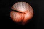 Riester 3900 Nasofaryngoskop Fiberoskop Endoskop