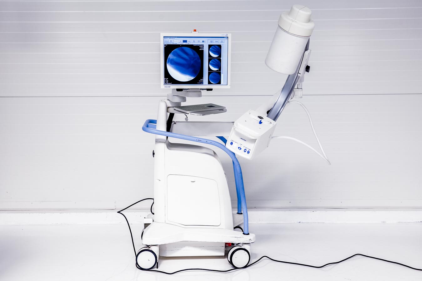 Hologic Fluoroscan InSight 2 Aparat RTG z Ramieniem C Hologic Fluoroscan InSight 2 Aparat RTG z Ramieniem C - obrazek 1