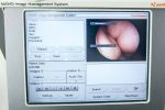 Smith & Nephew 660HD Zestaw Artroskopowy 500 XL 
