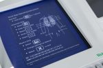 Welch Allyn CP 200 Aparat EKG Elektrokardiograf 2