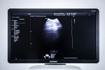 Samsung WS80A Elite Aparat USG Ultrasonograf