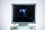 BK Medical PRO Focus 2202 Aparat USG Ultrasonograf