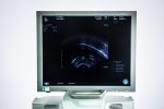 BK Medical PRO Focus 2202 Aparat USG Ultrasonograf