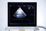 GE Vivid E9 Aparat USG Ultrasonograf UKG Echokardiograf 