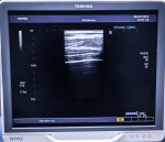 Głowica USG Liniowa Toshiba PLT-805AT Sonda