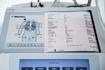 MORTARA ELI 280 Aparat EKG Elektrokardiograf 1