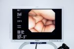 Olympus CV-260 CLV-260 Evis Lucera Zestaw Endoskopowy Kolonoskopia