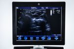 Aparat USG GE Vivid S6 Ultrasonograf 2 Głowice