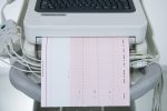 Philips Page Writer TC30 Aparat EKG Elektrokardiograf 2