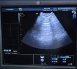 GE Healthcare RAB6-D Głowica 4D Sonda USG
