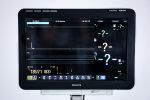Philips MX800 Moduł IntelliVue X2 Kardiomonitor Monitor Pacjenta
