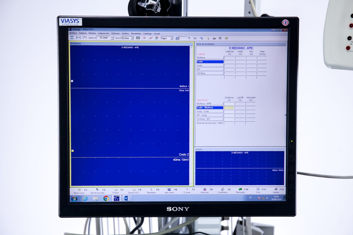 Medelec Synergy Zestaw do Elektromiografii EMG/NS/EP