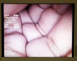 Olympus HD Endoeye WA50012A Wideo Laparoskop Endoskop (1)