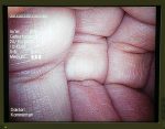 Olympus HD Endoeye WA50012A Wideo Laparoskop Endoskop (3)