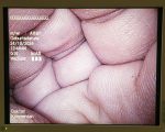 Olympus HD Endoeye WA50012A Wideo Laparoskop Endoskop (4)