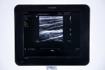Philips Sparq Aparat USG Ultrasonograf + 2 Głowice