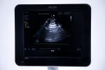 Philips Sparq Aparat USG Ultrasonograf + 2 Głowice