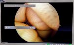 Smith & Nephew 72202959 Artroskop 4mm 30° Endoskop Optyka