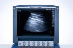 SonoSite MicroMaxx Aparat USG Ultrasonograf Przenośny Zestaw z głowicą (4/W) - obrazek 6