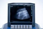 SonoSite MicroMaxx Aparat USG Ultrasonograf Przenośny Zestaw z głowicą (5) - obrazek 6