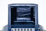 SonoSite MicroMaxx Aparat USG Ultrasonograf Przenośny Zestaw 3 głowice (1) - obrazek 7