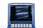 SonoSite MicroMaxx Aparat USG Ultrasonograf Przenośny Zestaw 2 głowice (3/P) - obrazek 7