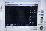 Fukuda Denshi DS-8500 Dynascope Monitor Pacjenta z Ramieniem - obrazek 5
