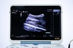 Esaote MyLab Alpha Przenośny Ultrasonograf USG Zestaw 2 głowice - obrazek 6
