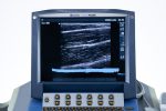 SonoSite MicroMaxx Aparat USG Ultrasonograf Przenośny Zestaw 3 głowice (1) - obrazek 9