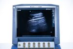 SonoSite MicroMaxx Aparat USG Ultrasonograf Przenośny Zestaw 2 głowice (3/P) - obrazek 5