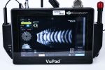 Sonomed Escalon VuPad Ultrasonograf Okulistyczny USG - obrazek 5