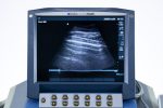 SonoSite MicroMaxx Aparat USG Ultrasonograf Przenośny Zestaw 3 głowice (1) - obrazek 11