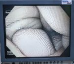 Olympus GIF H180 Wideo-Gastroskop Endoskop Giętki - obrazek 9