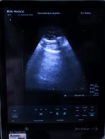 BK Medical 8823 Głowica USG Convex Sonda - obrazek 6