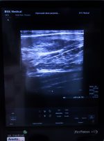 BK Medical 8870 Głowica USG Liniowa Sonda - obrazek 7