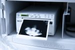 USG GE Voluson E8 BT18 Ultrasonograf + 2 Głowice 3D/4D - obrazek 8
