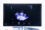 USG GE Voluson E8 BT18 Ultrasonograf + 2 Głowice 3D/4D - obrazek 7