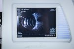 Sonomed E-Z Scan AB5500+ Ultrasonograf Okulistyczny USG - obrazek 6