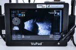 Sonomed Escalon VuPad Ultrasonograf Okulistyczny USG - obrazek 5
