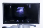 GE Voluson E8 BT21 Aparat USG Ultrasonograf + 2 Głowice 3D/4D - obrazek 8