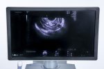 GE Voluson E8 BT21 Aparat USG Ultrasonograf + 2 Głowice 3D/4D - obrazek 7