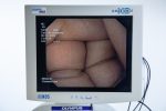 Olympus Evis Exera II CV-180 CLV-180 GIF Q180 Zestaw Endoskopowy - obrazek 6